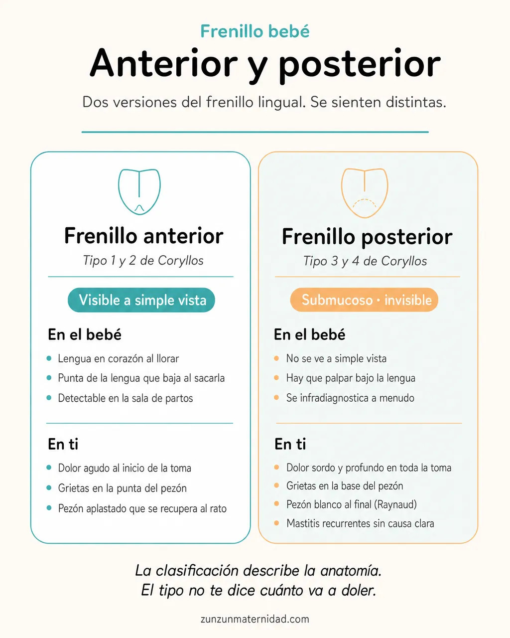 Comparativa visual entre frenillo anterior (tipo 1 y 2 de Coryllos) y frenillo posterior (tipo 3 y 4): señales en el bebé y en la madre.